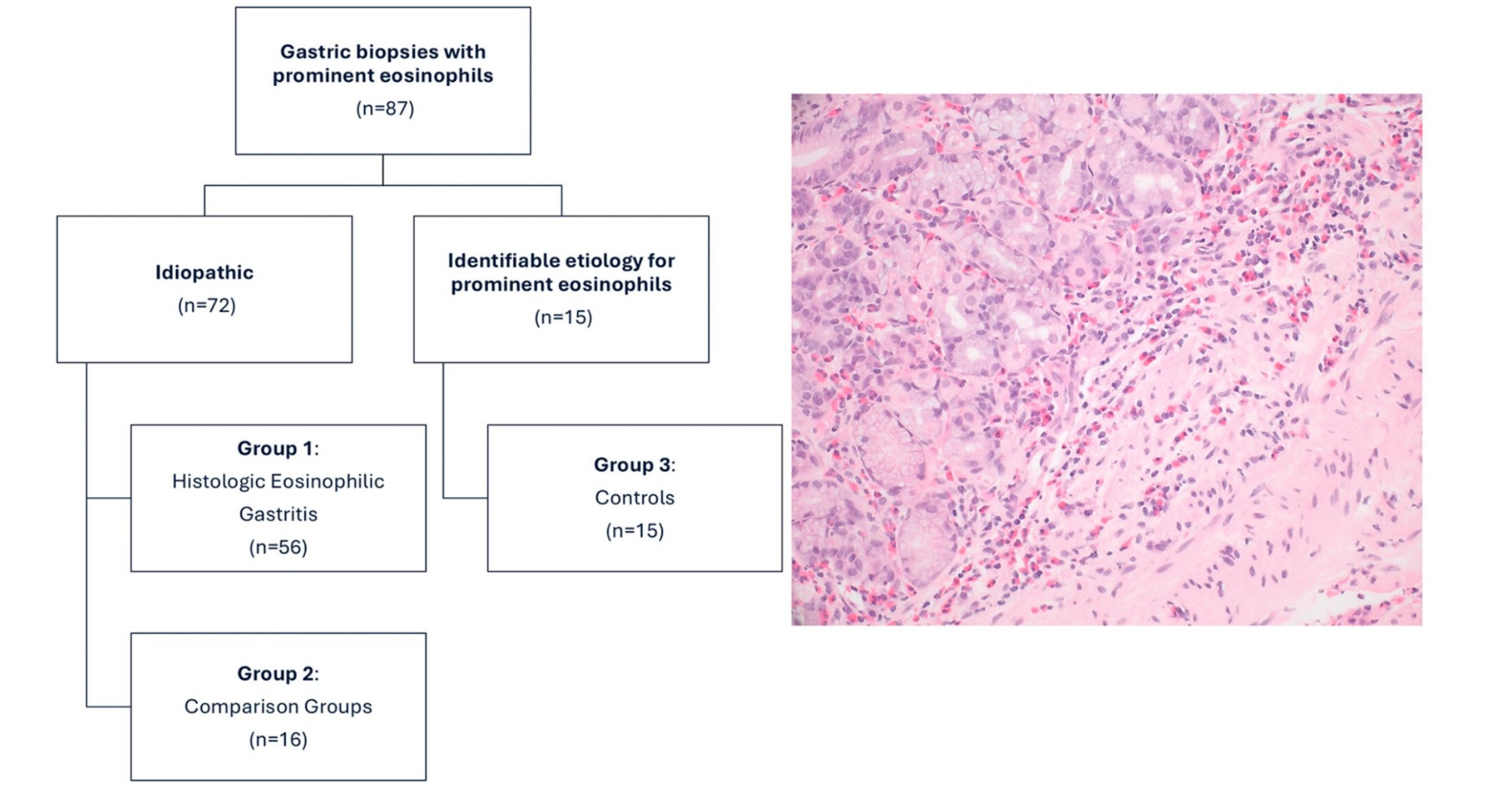 Genetic correlates of malignancy in TFE3-rearranged PEComa: a series of 14 cases